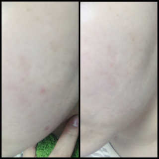 23years old 바데카실P — 4.5점을 준 리뷰어가 2017년 1월 올린 사용 사진