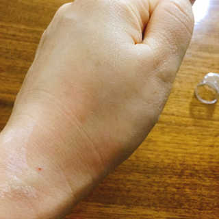닥터펩티 제이앤코슈 펩타이드 볼륨 에센스 — 4.5점을 준 리뷰어가 2019년 4월 올린 사용 사진