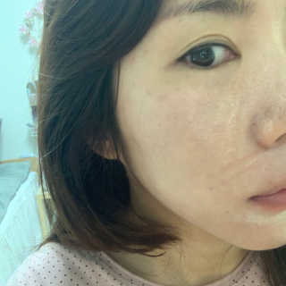 톤28 유기농 블루라이트 방어 UV 차단거리 지성용 B2 — 2.5점을 준 리뷰어가 2019년 5월 올린 사용 사진