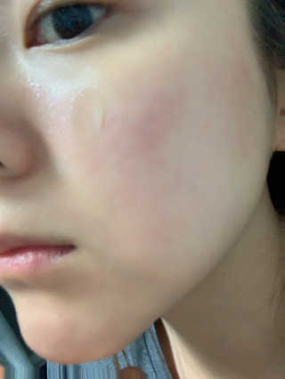 미샤 타임레볼루션 개똥쑥 진정 크림 — 5점을 준 리뷰어가 2020년 1월 올린 사용 사진
