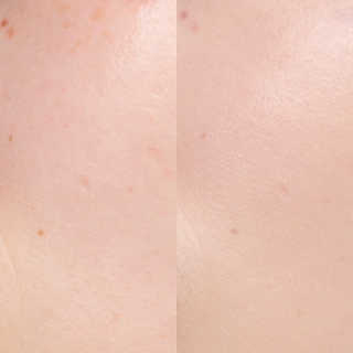 지고트 미네랄 UV 스네일 쿠션 리필포함 — 4점을 준 리뷰어가 2019년 7월 올린 사용 사진