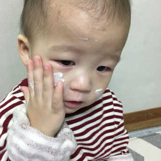 벨보이 스튜디오 벨보이스튜디오 케어젠 수딩 더마크림 — 4.5점을 준 리뷰어가 2017년 2월 올린 사용 사진