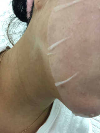 메이베나 1일 1팩 뽑아쓰는 마스크팩 — 5점을 준 리뷰어가 2019년 2월 올린 사용 사진