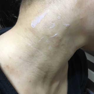 23years old 바데카실 오리지널 — 5점을 준 리뷰어가 2018년 2월 올린 사용 사진