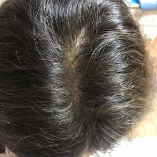 다슈코리아 다슈 컬러 페스트 체인지 염색약 — 5점을 준 리뷰어가 2019년 1월 올린 사용 사진