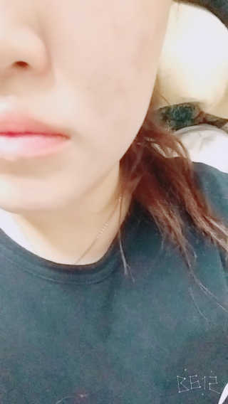 나이팅게일-토닝 필링패드 허니 — 5점을 준 리뷰어가 2017년 11월 올린 사용 사진