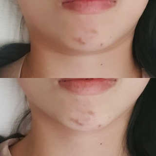 beauty_chanran님이 올린 리뷰 사진 4