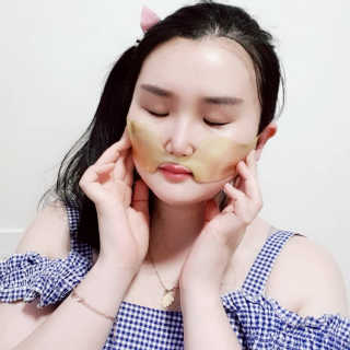 [스케덤] 상악밴드 — 3점을 준 리뷰어가 2019년 6월 올린 사용 사진