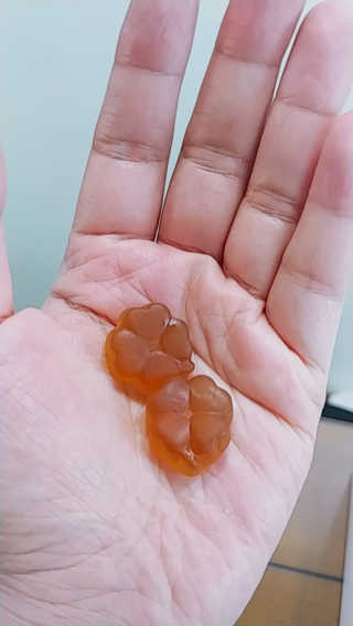 프롬바이오 [1+1] 홍쓰다스 와일드망고 다이어트 구미 10일분 — 4.5점을 준 리뷰어가 2019년 12월 올린 사용 사진