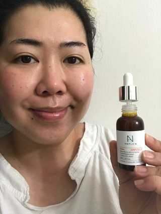 앰플엔 AMPLEN VC SHOT AMPOULE — 5점을 준 리뷰어가 2018년 12월 올린 사용 사진