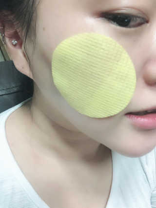 쏘내추럴 샤이닝 페이스 필링 패드 — 4점을 준 리뷰어가 2018년 8월 올린 사용 사진