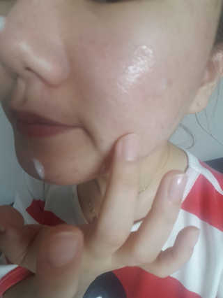 포렌코즈 아쿠아 커넥션 크림 — 5점을 준 리뷰어가 2017년 8월 올린 사용 사진