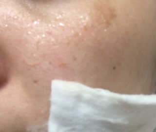 세포랩 바이오제닉 에센스 30ml 특별팩 — 4점을 준 리뷰어가 2018년 5월 올린 사용 사진