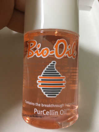 Bio-oil(바이오오일) 바이오오일 — 4.5점을 준 리뷰어가 2016년 10월 올린 사용 사진
