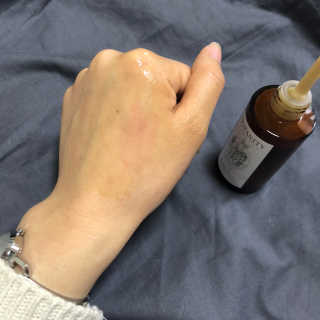 보타니티 [홍]조[진]정[결]케어 플라본 세럼 — 4.33점을 준 리뷰어가 2018년 5월 올린 사용 사진