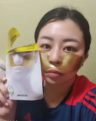[스케덤] 상악밴드 — 5점을 준 리뷰어가 2019년 6월 올린 사용 사진