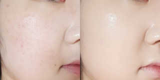 비니비니님이 올린 리뷰 사진 4