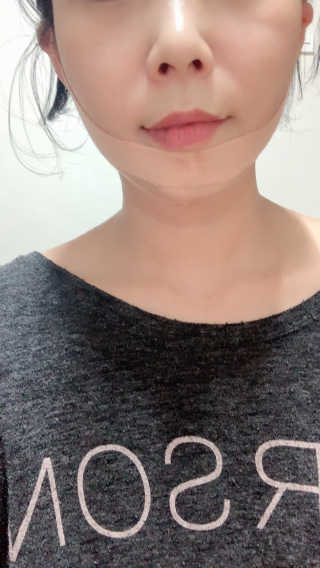 아이디플라코스메틱 아이디 페이스핏 마이너스 밴드 — 5점을 준 리뷰어가 2019년 10월 올린 사용 사진