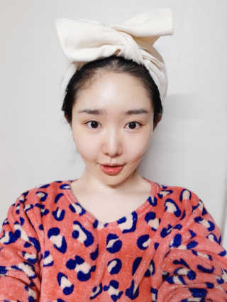 아이디플라코스메틱 아이디 페이스핏 마이너스 밴드 — 5점을 준 리뷰어가 2020년 3월 올린 사용 사진