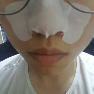 나이팅게일 TAKO PACK NOSE [문어코팩] — 4점을 준 리뷰어가 2017년 6월 올린 사용 사진