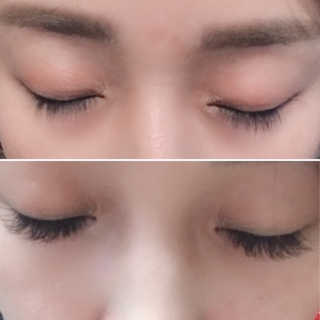 Viewty Skin and Lash [ViewtySkin＆Lash] 종아리 림프순환 부종관리 — 2점을 준 리뷰어가 2019년 4월 올린 사용 사진