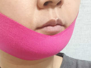 스케덤 펩타이드 리프팅밴드 — 5점을 준 리뷰어가 2019년 3월 올린 사용 사진
