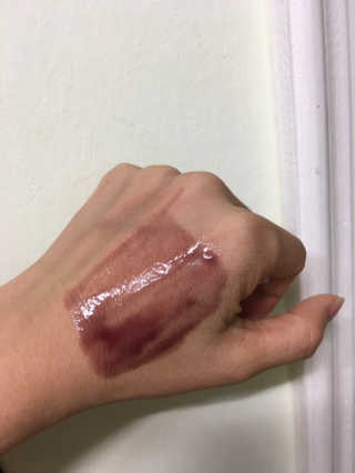 쏘내추럴 레드 필 팅글 세럼 오리지널 — 5점을 준 리뷰어가 2019년 8월 올린 사용 사진