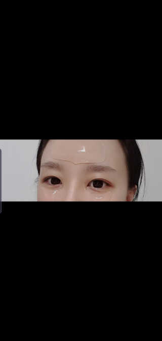 아이디플라코스메틱 아이디 페이스핏 플러스 패치 — 4점을 준 리뷰어가 2019년 10월 올린 사용 사진