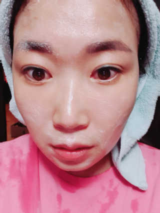 토모토끼 하이드랄라 미스티폼 — 5점을 준 리뷰어가 2019년 9월 올린 사용 사진