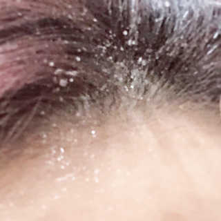 바로티나 [리뷰 상품권 이벤트] 즉시 굵어지는 헤어볼륨S — 4.5점을 준 리뷰어가 2019년 10월 올린 사용 사진