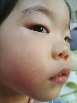 💟봉달💟님이 올린 리뷰 사진 3