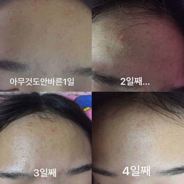 바데카실P 리뷰 사진