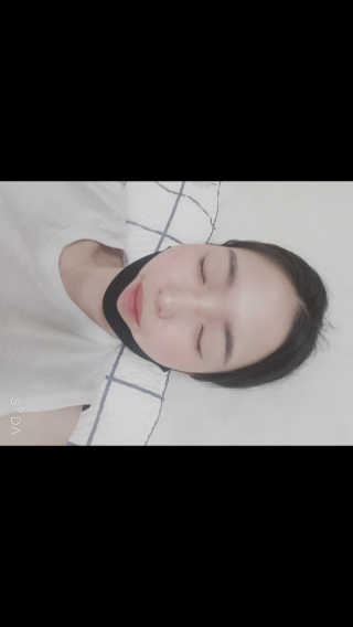 프리티스킨 디자인 유어 뷰티 브이라인 패치 — 5점을 준 리뷰어가 2019년 6월 올린 사용 사진