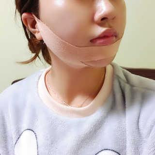 아이디플라코스메틱 아이디 페이스핏 마이너스 밴드 — 4점을 준 리뷰어가 2019년 12월 올린 사용 사진