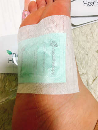 메디테라피 더마 릴렉스 힐링패치 — 3점을 준 리뷰어가 2018년 4월 올린 사용 사진