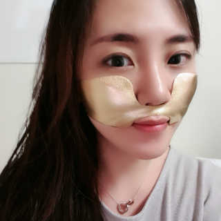 [스케덤] 상악밴드 — 5점을 준 리뷰어가 2019년 6월 올린 사용 사진