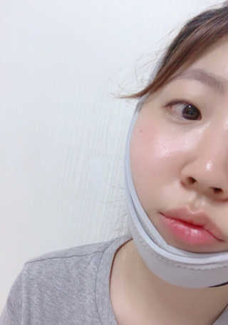 메디미 브이미 업 2스텝 브이라인벨트 — 4.67점을 준 리뷰어가 2017년 6월 올린 사용 사진