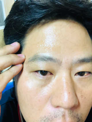 셀리맥스 노니 에너지 앰플 — 5점을 준 리뷰어가 2019년 9월 올린 사용 사진