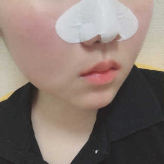 미팩토리 3단 돼지코팩 3매입 X 2EA — 3.5점을 준 리뷰어가 2019년 6월 올린 사용 사진