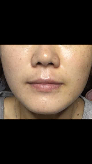 코스노리 수퍼비타 데이라이트 디펜스 썬블럭 — 4점을 준 리뷰어가 2018년 5월 올린 사용 사진