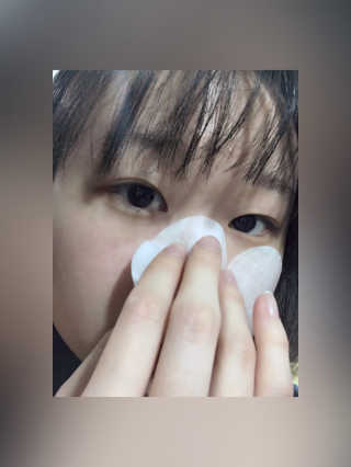 홈메디케어 티트리마스크패드 — 4.5점을 준 리뷰어가 2018년 5월 올린 사용 사진