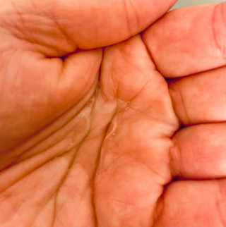 [마녀 공장] 발가락 토미 니아신 에센스 50ml — 5점을 준 리뷰어가 2019년 4월 올린 사용 사진