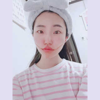 아이디플라코스메틱 아이디 페이스핏 마이너스 밴드 — 4.5점을 준 리뷰어가 2020년 3월 올린 사용 사진