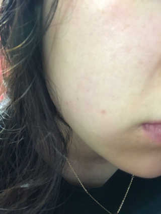 하루콩콩님이 올린 리뷰 사진 2