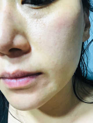타임인네이처 [더메디닥터] 카렌듈라 엔자임 필링젤 — 4점을 준 리뷰어가 2019년 3월 올린 사용 사진