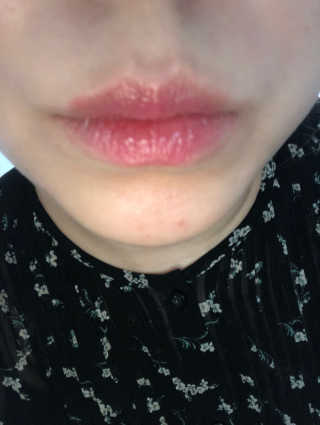 테라다이아 립 메이트 오일 — 4.5점을 준 리뷰어가 2018년 6월 올린 사용 사진