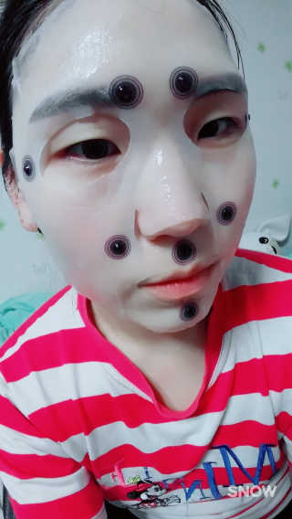 메디힐 바이오포인트 서클포인트마스크 3종 — 5점을 준 리뷰어가 2017년 5월 올린 사용 사진