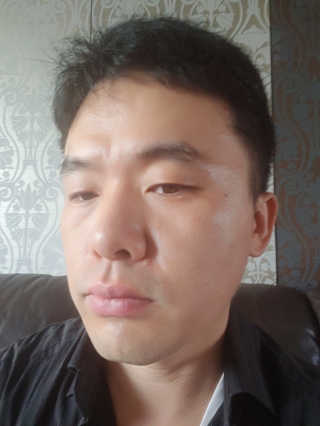 S2 성미당 S2 슈퍼 쉴드 유브이 선스크린 100 — 5점을 준 리뷰어가 2019년 6월 올린 사용 사진
