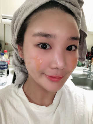 메디페르루테인앰플 3종 — 5점을 준 리뷰어가 2019년 8월 올린 사용 사진