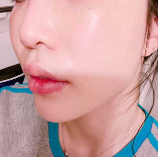 Dr.메디션 본래의 피부로 되돌려주는 리턴미백에센스 — 3.83점을 준 리뷰어가 2018년 9월 올린 사용 사진